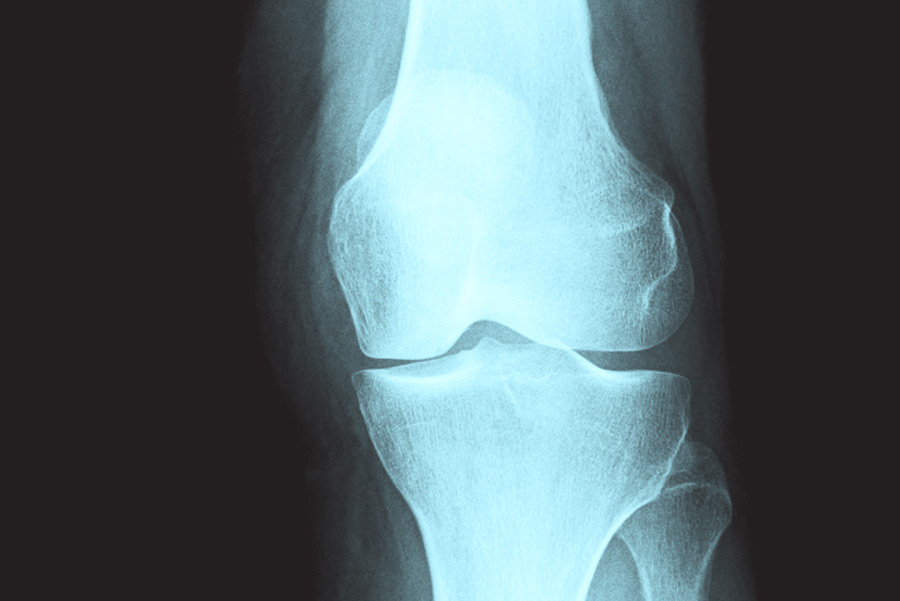 Bone Mineral Density - Radiologie et Imagerie médicale de la Capitale